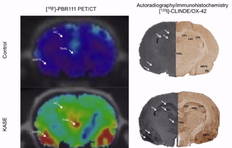 PET Brain Images